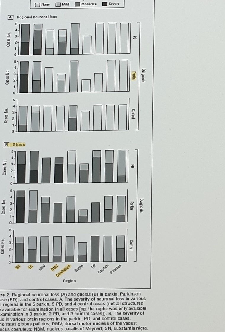 Regional neuronal loss and gliosis