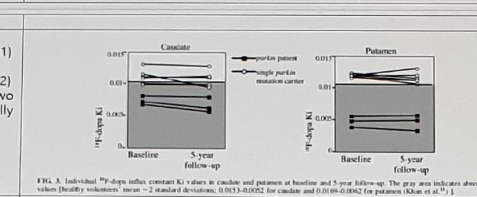 Pavese/Khan 18F-dopa longitudinal figure