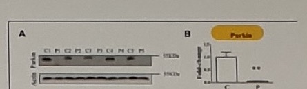 Zilocchi Parkin levels western blot and bar plot